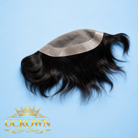Hair Patch Services