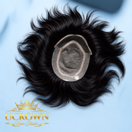 Hair Patch Services